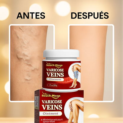 VARICOSE VEINS CREMA PARA VARICES